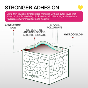 Kormesic แผ่นแปะรักษาสิวสำหรับดูแลผิว48ชิ้น/กล่องแผ่นกันสิวที่มีสีสันรูปหัวใจผีเสื้อดอกไม้กันน้ำ - Product Image 4