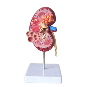 Aides pédagogiques médicales, modè<span class=keywords><strong>le</strong></span> anatomique de rein en PVC avec des caractéristiques normales <span class=keywords><strong>et</strong></span> pathologiques pour l'enseignement des sciences médicales - Product Image 2