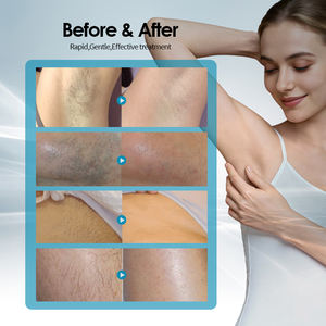 Machine à diode laser KES Big Power 808NM, <span class=keywords><strong>épilation</strong></span> au laser à diode populaire pour les peaux foncées - Product Image 6