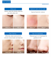 Appareil de microdermabrasion Hydra Peel, hydrodermabrasion, machine faciale, technologie de jet d'oxygène, dermabrasion, fonctions hydratantes CN