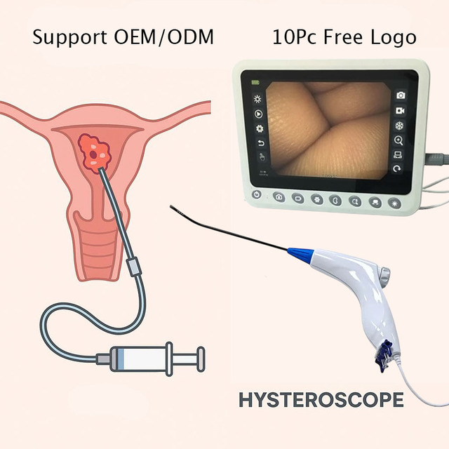 Disposable Flexible Hysteroscope  With Mini Camera Customized Connector for Human Market Medical Endoscope Usb Camera