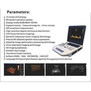 Vivatest - Instrumento de Diagnóstico por Ultrasonido Veterinario para Hospitales de Animales con Parámetros Preestablecidos Integrados para Varios Animales - Product Image 2