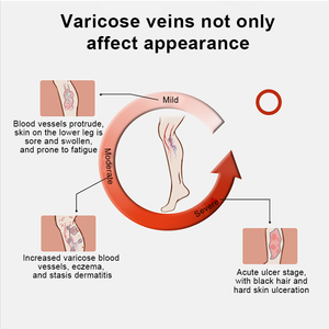 Manchons de jambe de <span class=keywords><strong>compression</strong></span> à gradient de Offre Spéciale Spandex Polyester et nylon pour l'entraînement et la protection quotidiens des jambes - Product Image 3