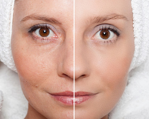 Crema Facial Coreana para el Cuidado de la Piel, Efecto Lifting Instantáneo, Reafirmante, Antiarrugas, Antienvejecimiento, con Colágeno, NAD, PDRN, para Todo Tipo de Piel, OEM, ODM - Product Image 5
