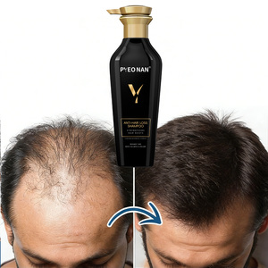 Champú Herbal Anticaspa para Cabello Graso con Queratina, <span class=keywords><strong>Biotina</strong></span>, Colágeno y Cafeína para el Crecimiento del Cabello y Contra la Caída - Product Image 3