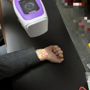 Mesin Pencari Vena Inframerah Portable untuk Wajah dengan Stand - Product Image 4