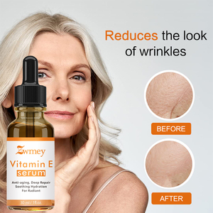 Bán buôn nhãn hiệu riêng 100% tinh khiết chăm sóc da tự nhiên phai mụn huyết thanh kiểm soát dầu lỏng làm sáng mụn đánh dấu lỗ chân lông thu hẹp hàng rào - Product Image 5