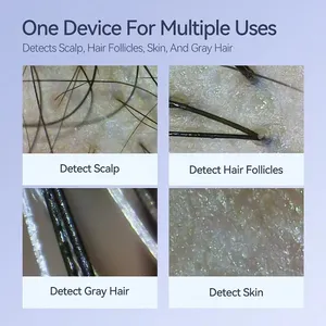 Dermatoscope numérique HD 50X/200X pour l'analyse de la peau et du cuir chevelu, appareil de diagnostic cutané et outil de soin de la peau. - Product Image 3