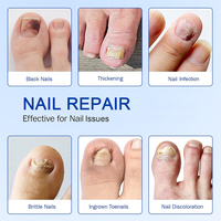 Patch réparateur d'ongles multi-usages adoucit les ongles épais humidifiés prévient l'infection fongique traite les champignons des ongles