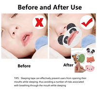 Bande adhésive buccale en forme d'anneau pour enfants pour dormir, OEM, bandes de sommeil indolores pour enfants, patch anti-respiration buccale, confortable toute la nuit