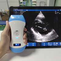 Ecógrafo de Bolsillo Portátil con Transductor Doppler Color JM-5CPL 3 en 1 para Uso Humano y Veterinario