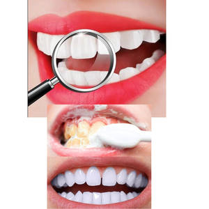 Nano technologie soins dentaires hygiène buccale blanchiment des dents 20g élimine les taches de fumée café thé fraîcheur papa poudre respiratoire - Product Image 3