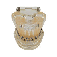 Modelo de Ortodoncia Dental de Resina, Tipodonto con Soporte Metálico, Demostrador de Estudio Dental, Uso Manual, Smiledental TM-B7-01