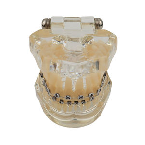 Dental Orthodontic Model Resin Typodont with Metal Bracket <b>Teeth</b> Study Teaching Demonstrator Manual Use Smiledental TM-B7-01 - Product Image 1