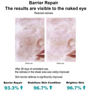 Pele do reparo após o tratamento do laser <span class=keywords><strong>Peel</strong></span> químico e outras intervenções da pele Tipo humanizado recombinante III soro do gel do colagénio - Product Image 4