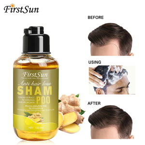 Mejor Precio ingredientes naturales jengibre caída del <span class=keywords><strong>cabello</strong></span> tratamiento <span class=keywords><strong>contra</strong></span> la pérdida del pelo champú para mujer - Product Image 2