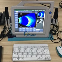 Sistema de Ultrasonido Oftalmológico EOMED A/B para Diagnóstico Ocular, Resultados de IOL, Imágenes B-scan, Modelo EUS2300S, 1 Año de Garantía