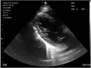 B26D 192E 3in1 <span class=keywords><strong>Portable</strong></span> Ginecologia sonde transvaginale et abdominale Scanner à ultrasons vétérinaire <span class=keywords><strong>Sonosite</strong></span> de gynécologie <span class=keywords><strong>portable</strong></span> pour OB - Product Image 6