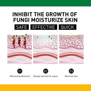 Meilleures ventes de <span class=keywords><strong>crème</strong></span> de soin à base de plantes pour réparer les ampoules anti-démangeaisons des mains et des pieds - Product Image 5