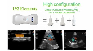 B26G 192 Elements <strong>Handheld</strong> Wireless Color <strong>Doppler</strong> Ultrasound Abdominal <strong>Vascular</strong> Cardiac Probe Machine - Product Image 2