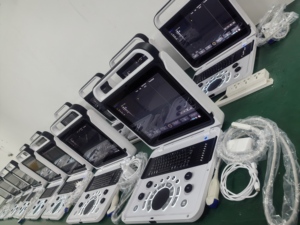 Портативный цифровой ультразвуковой аппарат - Product Image 6