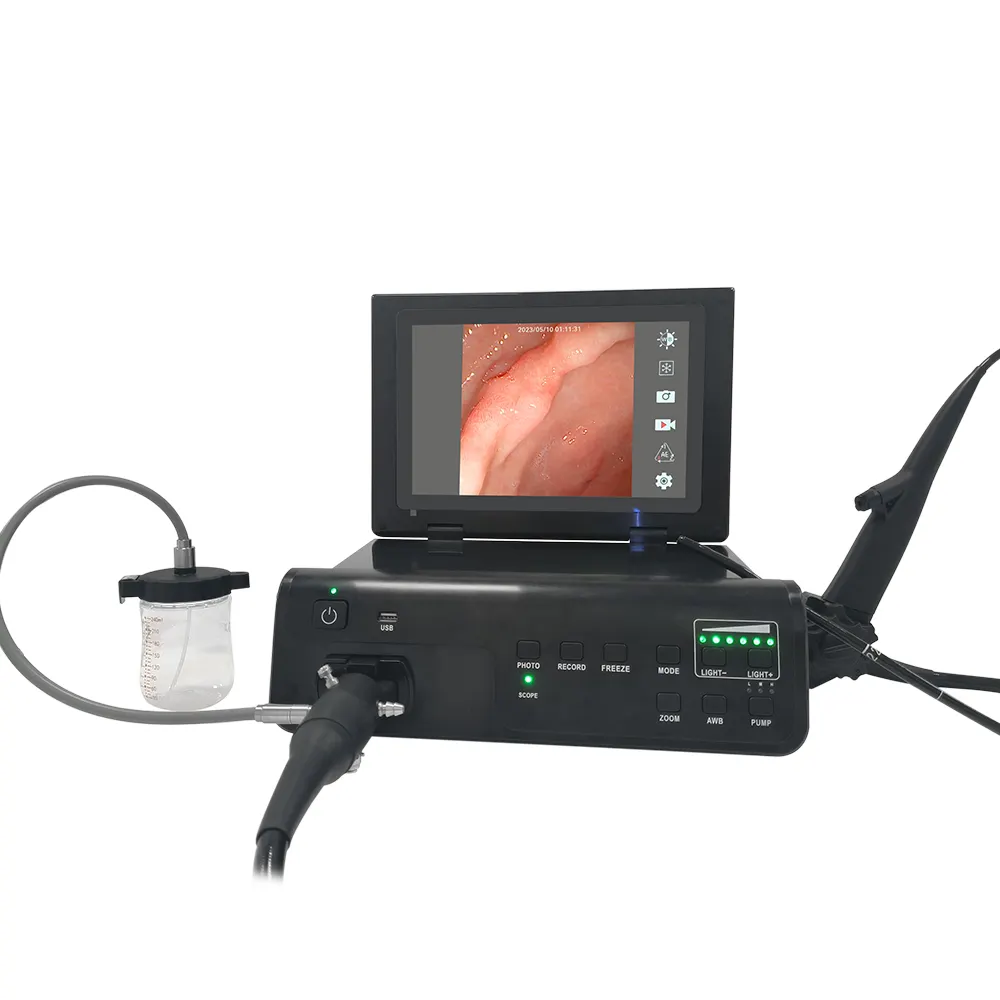 Nuovo gastroscopio endoscopio gastroscopio elettronico