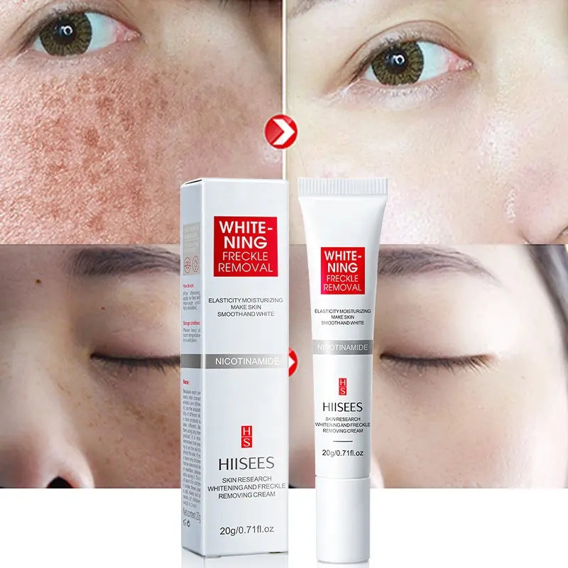 להסיר Melasma כהה כתמי מלנין פנים להאיר עור טיפול נגד הזדקנות עור לחות הלבנת נמש קרם