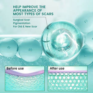 Crème cicatrisante biologique Sumifun, crème pour éliminer les boutons, les vergetures, 20 g - Product Image 6