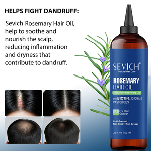 Aceite esencial de romero y jojoba de gran venta, Aceite Esencial Hidratante nutritivo ordinario para el cuidado del <span class=keywords><strong>cabello</strong></span> para el <span class=keywords><strong>crecimiento</strong></span> del <span class=keywords><strong>cabello</strong></span> - Product Image 6