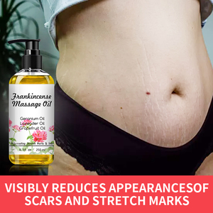 निजी लेबल प्राकृतिक लैवेंडर कैमोमाइल वार्मिंग आराम मालिश गले पेशी शरीर की मालिश तेल - Product Image 2