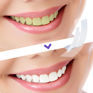 Offres Spéciales : Bandes Blanchissantes Efficaces pour les <span class=keywords><strong>Dents</strong></span> – Blanchiment Dentaire Professionnel - Product Image 4