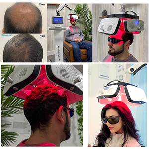 Machine de croissance de cheveux LLLT avec laser médical 424 pièces certifié CE USA - Product Image 5