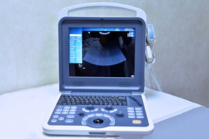 Máy Siêu Âm <span class=keywords><strong>Doppler</strong></span> Màu Chất Lượng Cao Với Chế Độ PW Hệ Thống Siêu Âm Siêu Âm Và Siêu Âm Tim - Product Image 2