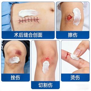 Apósito de Vidrio Bioactivo Yingchuang, Dispositivo Médico Clase II, Estimula la Angiogénesis para una Reparación de <span class=keywords><strong>Tejidos</strong></span> Más Rápida - Product Image 3