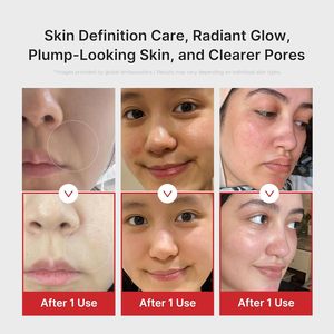 Masajeador Facial 6 en 1 Age-R Booster Pro con Cabezal de Vidrio Real, Recargable por USB, para una Piel Radiante, Dispositivo de Belleza Coreano - Product Image 4