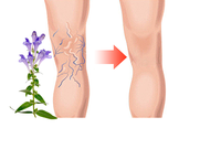 Gel de traitement des varices et des veines d'araignée à absorption rapide et anti-gonflement, composé d'Aescinate de sodium, personnalisé OEM, pour usage domestique, 50G