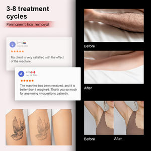 Meilleure vente plus récent 2-en-1 Nd Yag Laser épilation poignée 4 vagues 755 808 940 1064nm Diode Laser pour <span class=keywords><strong>tatouage</strong></span> haute 3000W CE - Product Image 4