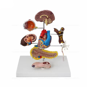 Modelo de Enseñanza de Ciencias Médicas, Patología Humana, <span class=keywords><strong>Diabetes</strong></span>, Anatomía <span class=keywords><strong>en</strong></span> PVC para Escuelas de Medicina - Product Image 1