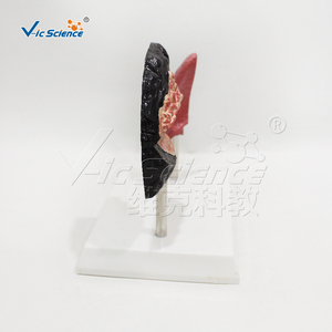 Modèle anatomique médical pour le tabagisme Modèle d'<span class=keywords><strong>anatomie</strong></span> humaine médicale Modèle de comparaison du <span class=keywords><strong>poumon</strong></span> fumeur de <span class=keywords><strong>poumon</strong></span> humain - Product Image 3