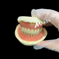 Prothèse Dentaire Complète d'Aspect Naturel - Prothèse Totale Premium pour Patients Édéntés