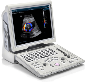 Sistema de Diagnóstico por Ultrasonido Doppler Color Portátil Mindray Z5, Adecuado para Aplicaciones Abdominales y Obstétricas/Ginecológicas. - Product Image 6