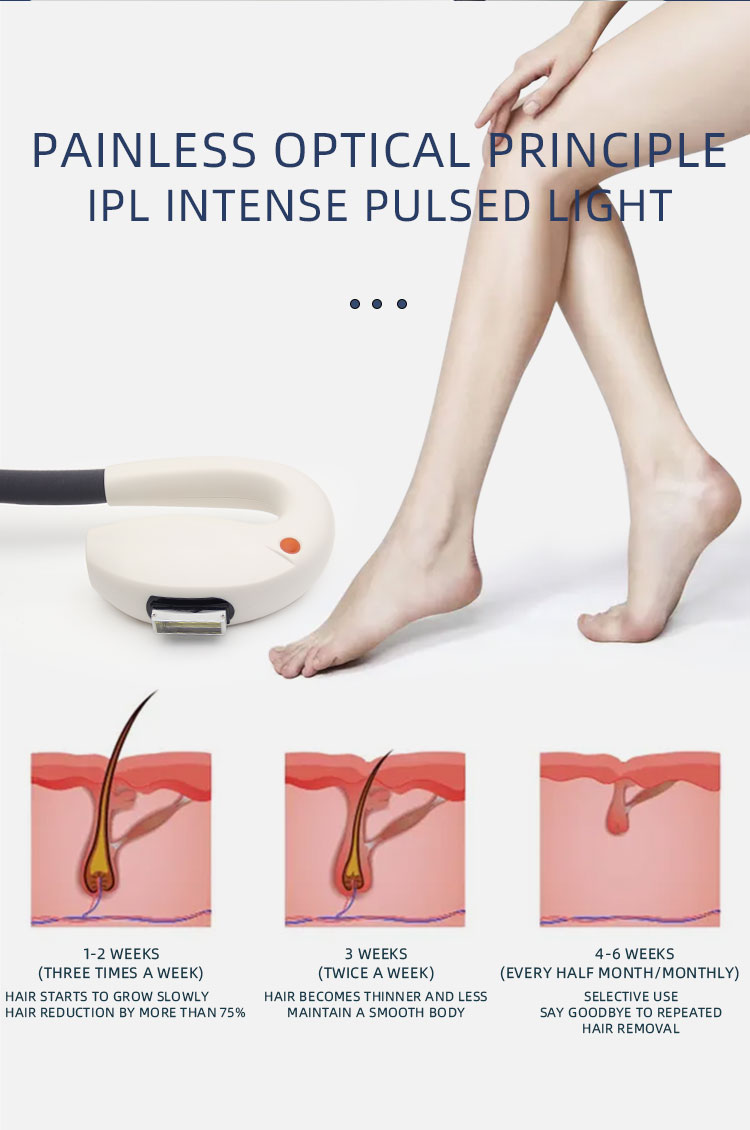 Epilator DPL Laser Hair Removal