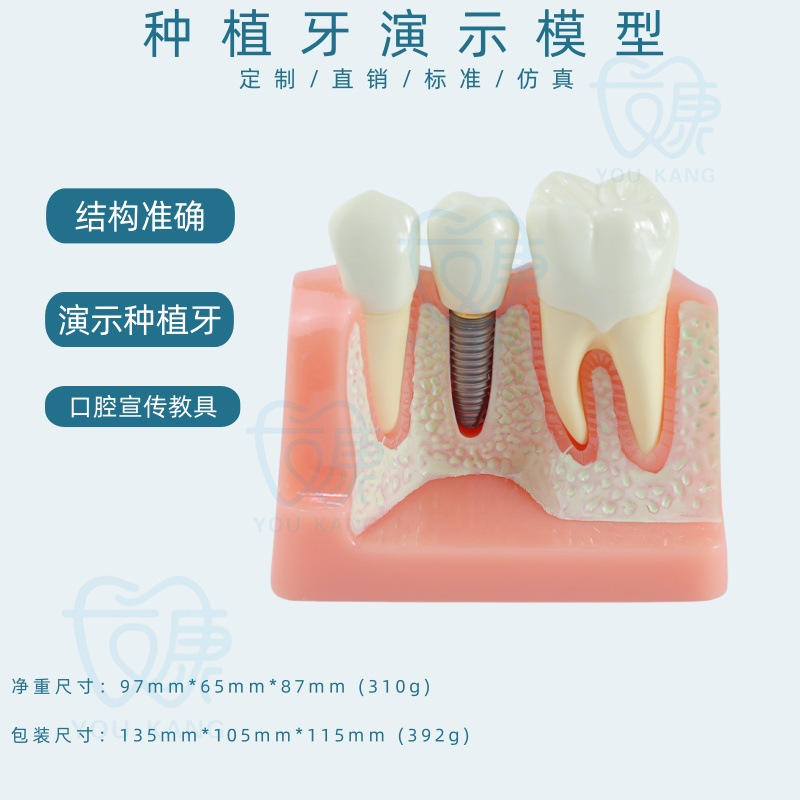 Nuevo implante dental