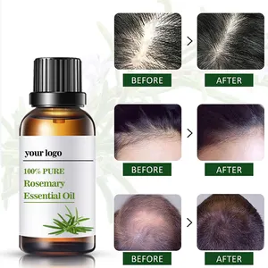 Olio essenziale di rosmarino di alta qualità per accelerare la crescita dei capelli puro olio naturale per la cura dei capelli