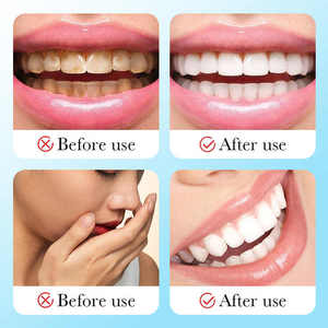<strong>Wholesale</strong> Travel Anti Scaling <strong>Sensodyne</strong> Fresh Mint <strong>Toothpaste</strong> Ginger Spearmint - Product Image 5