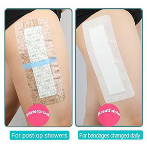 Penjualan terlaris pabrik grosir osisian darurat darurat Dressing pertolongan pertama dilepas segel dada untuk luka - Product Image 4