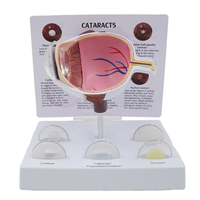 Modèle oculaire pathologique avec lentilles interchangeables pour la démonstration de la cataracte