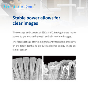 Sensor de Radiografía Digital Portátil Greatlife <span class=keywords><strong>Dent</strong></span> 65kv para Monitoreo Veterinario, Tecnología de Rayos X Dental, Portátil, Mejor Precio - Product Image 5