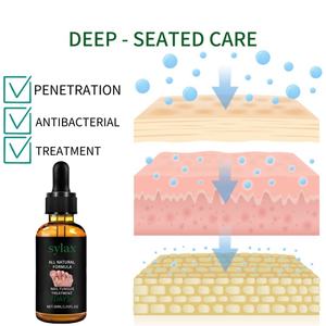 Suero Antifúngico Sylax de 30 ml para Nutrición Profunda, Tratamiento de Hongos <span class=keywords><strong>en</strong></span> las Uñas, Reparación de Uñas y Restauración de Uñas Saludables - Product Image 5