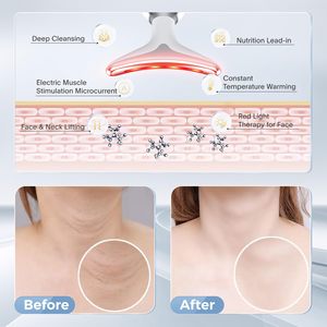 Masseur facial anti-âge ABS avec dispositif de raffermissement et de levage par vibration pour effet de <span class=keywords><strong>détumescence</strong></span> anti-rides de levage du cou - Product Image 5